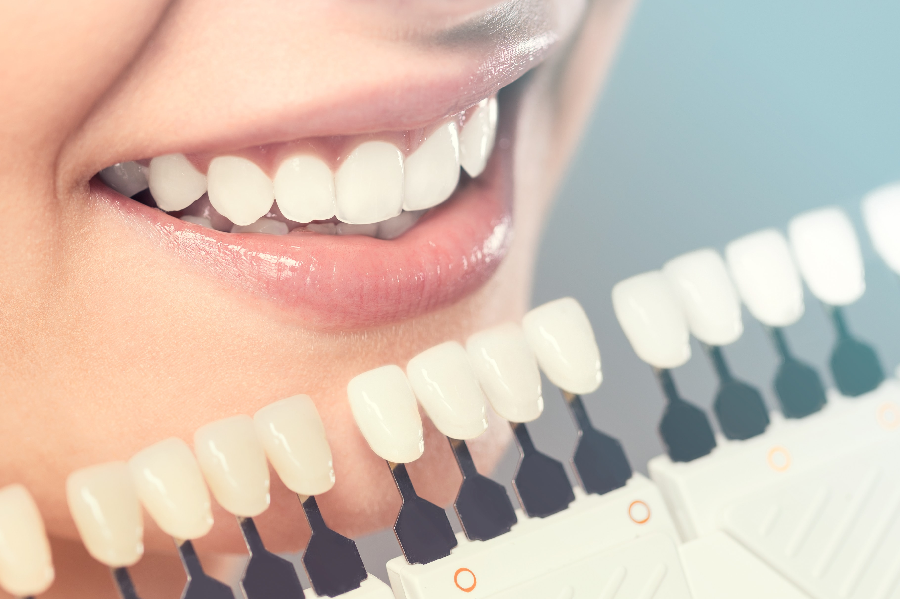 How To Know That You Need a Cosmetic Dentist Appointment?