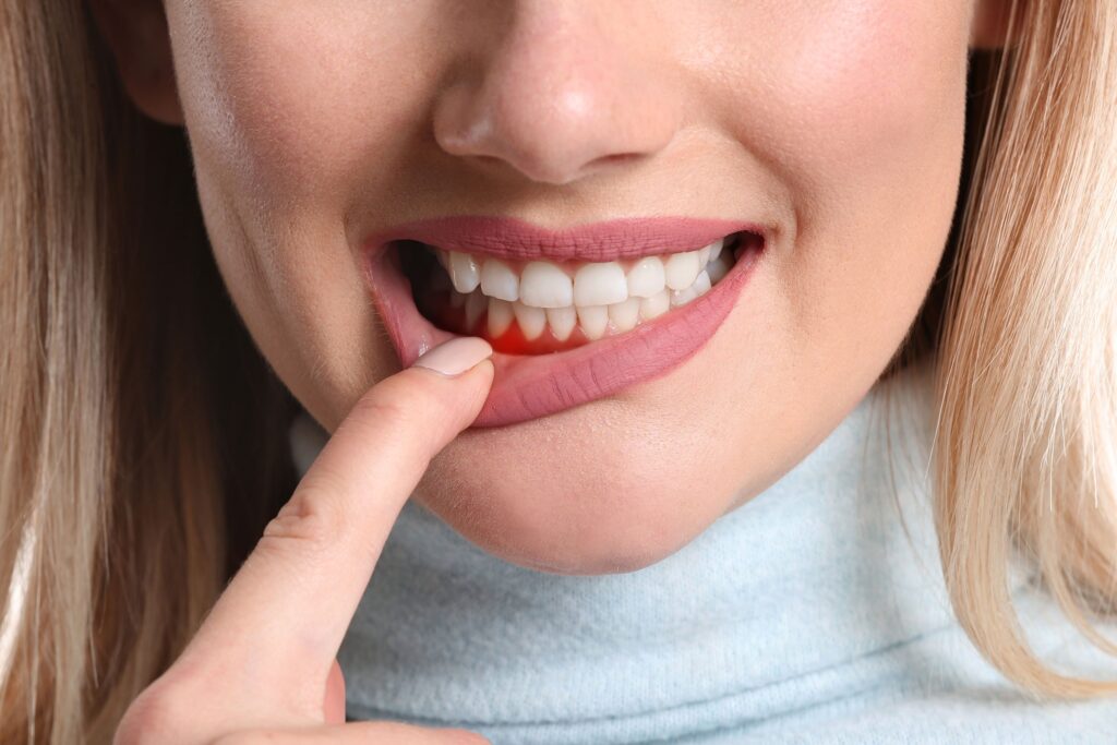 Periodontal Disease: Unraveling Your Gum Health