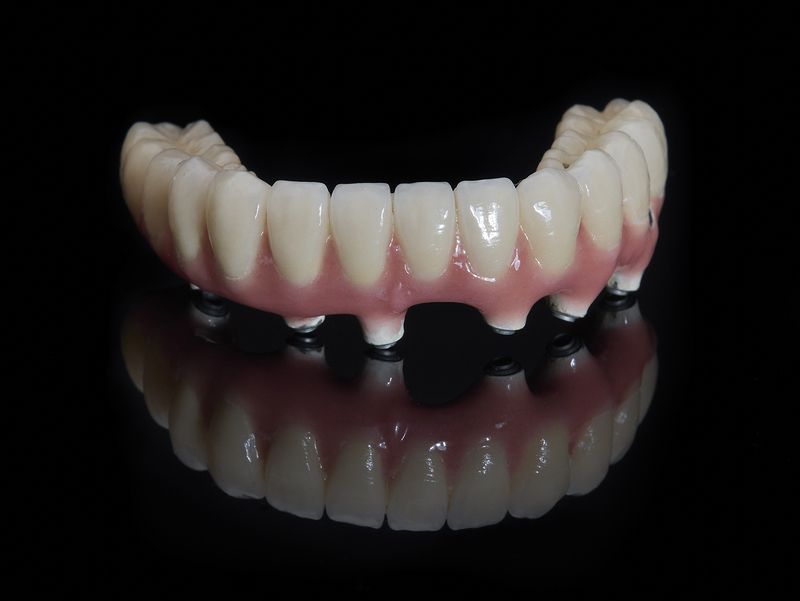 Can Dental Implants Work for Denture Wearers?